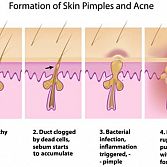 Acne Treatment Specialist Â· Dermatologist Â· Cosmetic Laser Dermatology NYC