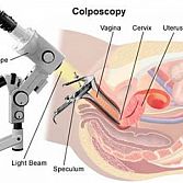 Colposcopy, Cervical Biopsy Â· Cervix Specialist, Doctor Â· Gynecologist Midtown Manhattan NYC