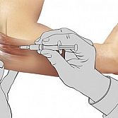  Elbow Injections (platelet-rich plasma, PRP) in NYC | Elbow Pain Doctors Specialists