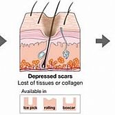 Scars Specialist Â· Dermatologist Â· Cosmetic Laser Dermatology NYC