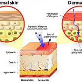 Seborrheic Dermatitis Â· Dermatologist Â· Cosmetic Laser Dermatology NYC